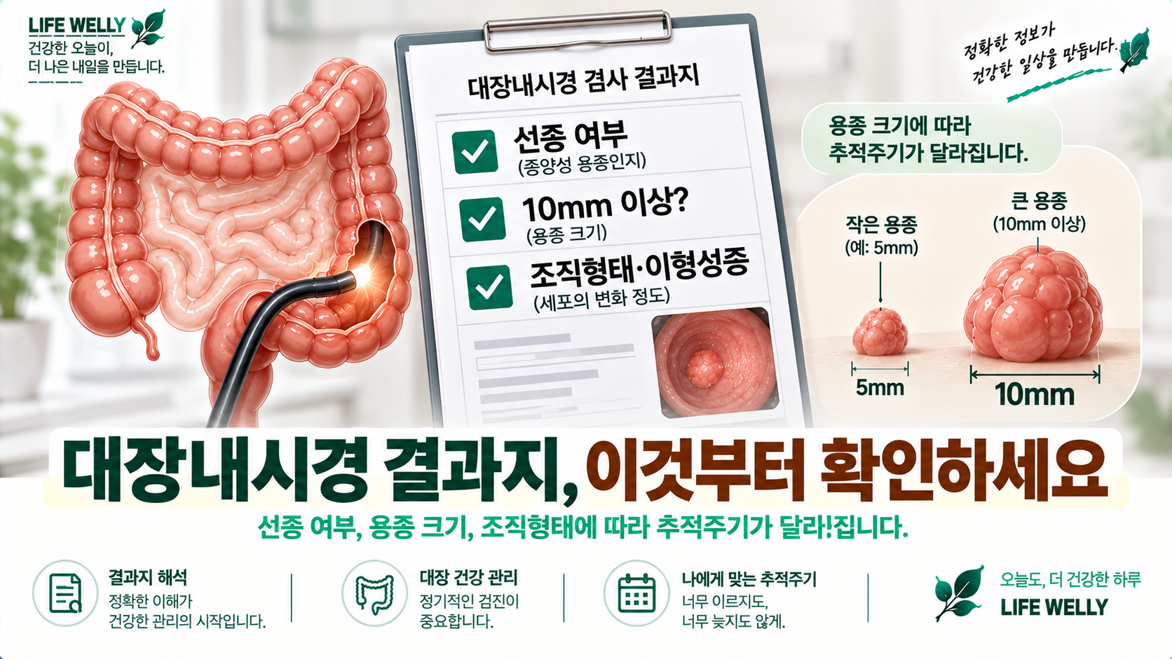 대장내시경 결과지에서 선종 여부 용종 크기 조직형태 이형성증과 추적주기를 확인하는 방법