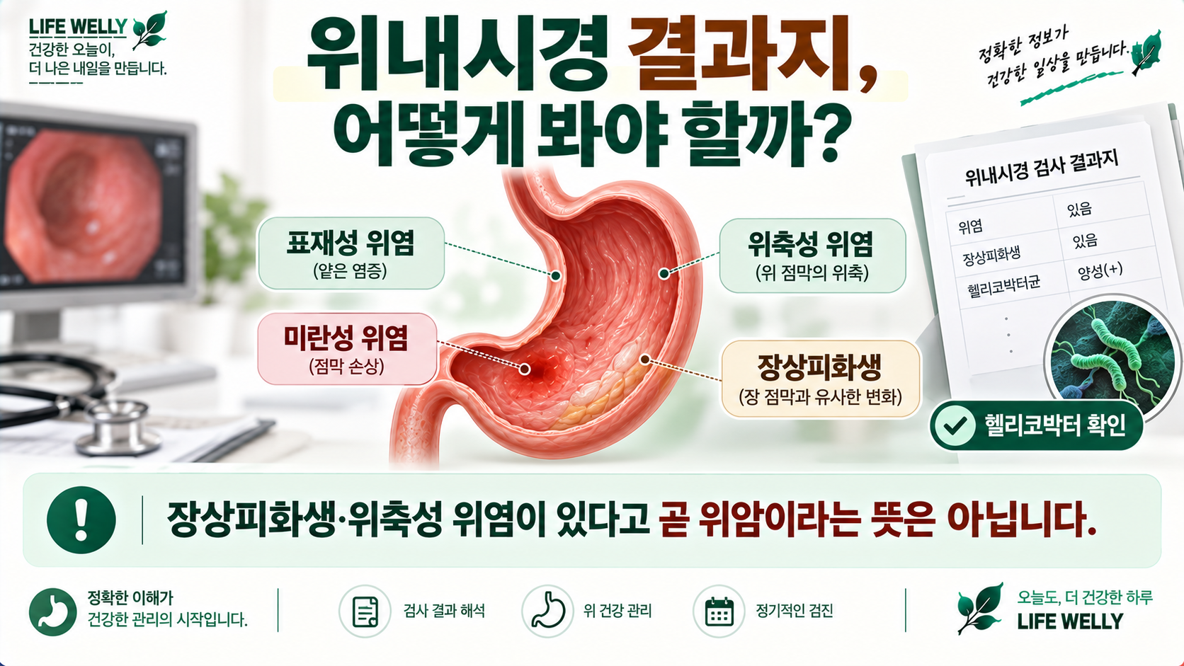 위내시경 결과지의 표재성 위염 미란성 위염 위축성 위염 장상피화생과 헬리코박터 해석
